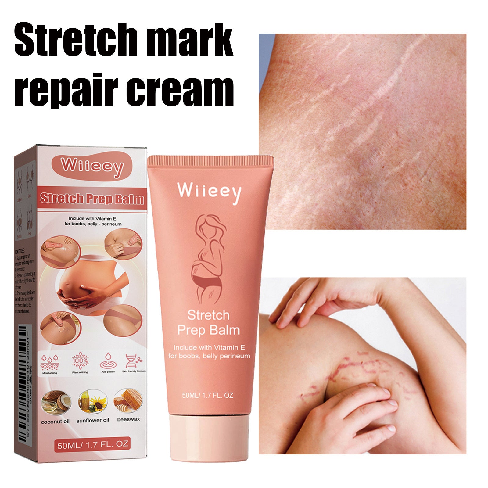 Stretch Mark and Cellulite Repair Balm Cream—Prevents and Fades with Natural Formula of Coconut Oil, Sunflower and Beeswax - GLOWUP