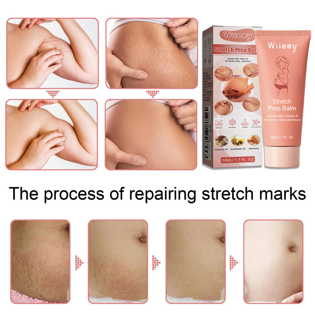 Stretch Mark and Cellulite Repair Balm Cream—Prevents and Fades with Natural Formula of Coconut Oil, Sunflower and Beeswax - GLOWUP