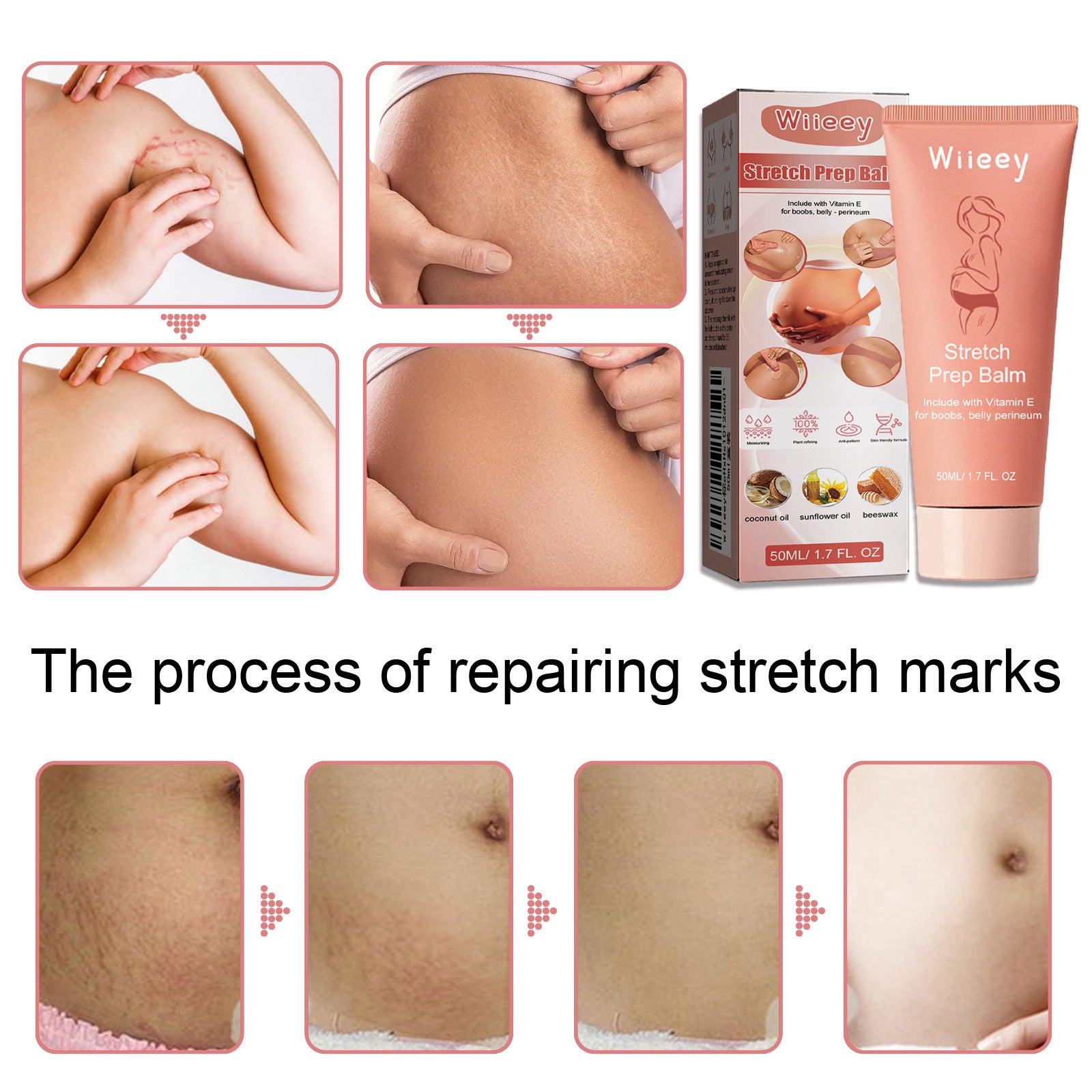 Stretch Mark and Cellulite Repair Balm Cream—Prevents and Fades with Natural Formula of Coconut Oil, Sunflower and Beeswax - GLOWUP