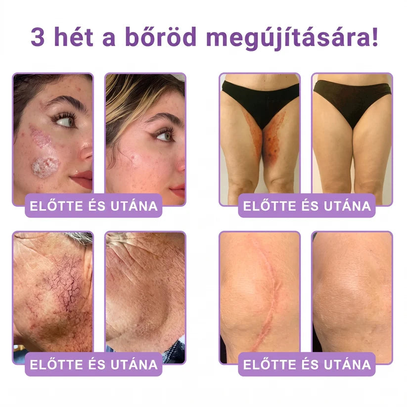 Recommended by dermatologists | PDRN Multi-Peptide Massaging Body Cream - GLOWUP