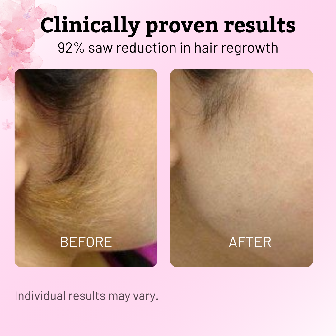 Natural Cyperus Rotundus Oil for Hair Removal - 60ml Growth Inhibitor for Face & Body - Pain-Free & Organic