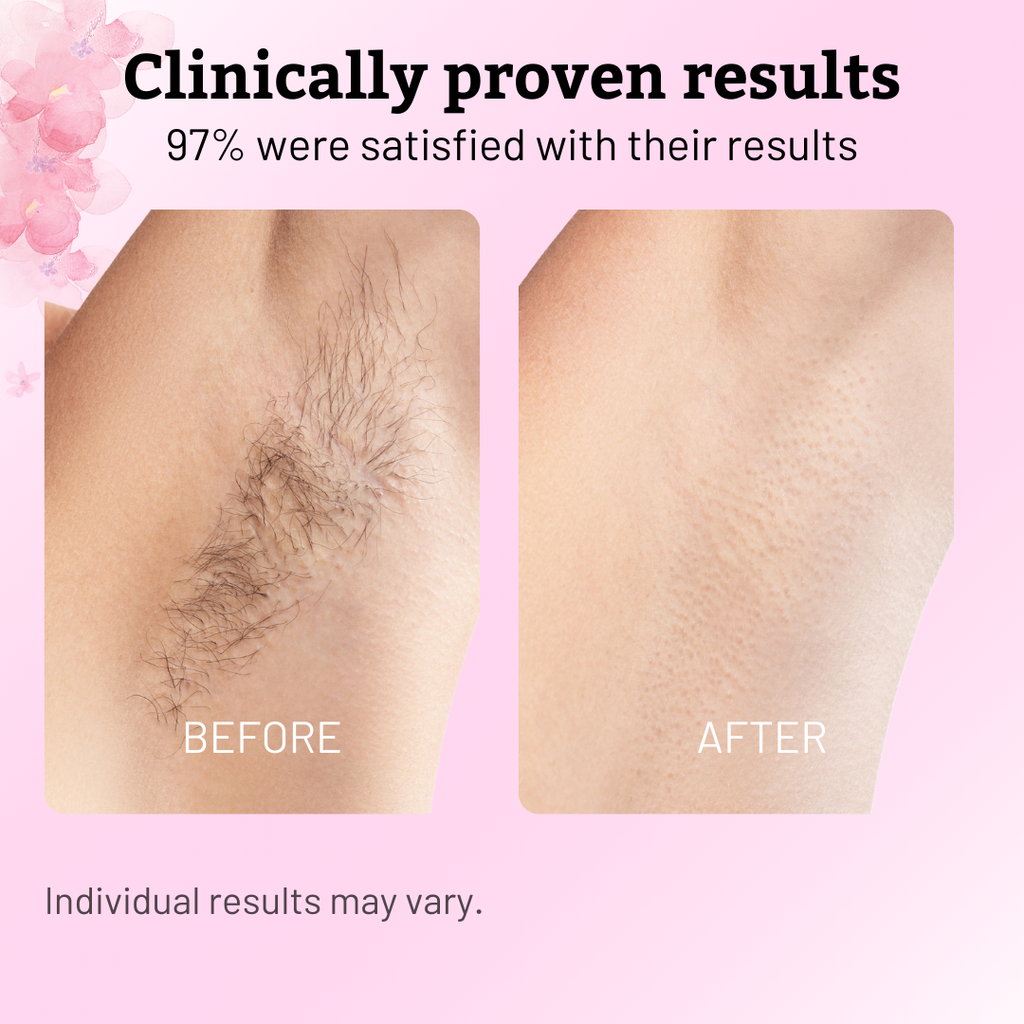 Natural Cyperus Rotundus Oil for Hair Removal - 60ml Growth Inhibitor for Face & Body - Pain-Free & Organic