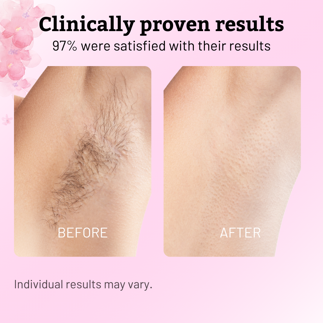Natural Cyperus Rotundus Oil for Hair Removal - 60ml Growth Inhibitor for Face & Body - Pain-Free & Organic