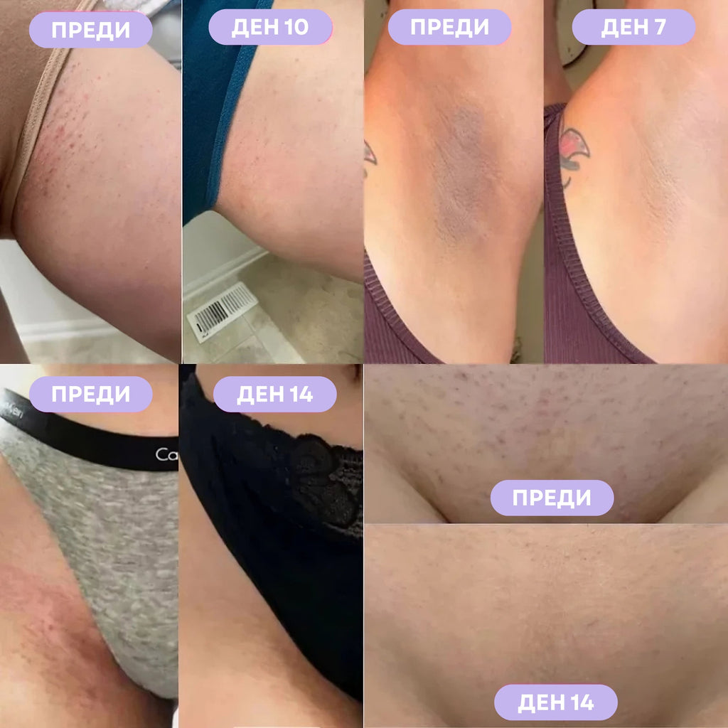 Anti-Ingrown Hair Serum - GLOWUP